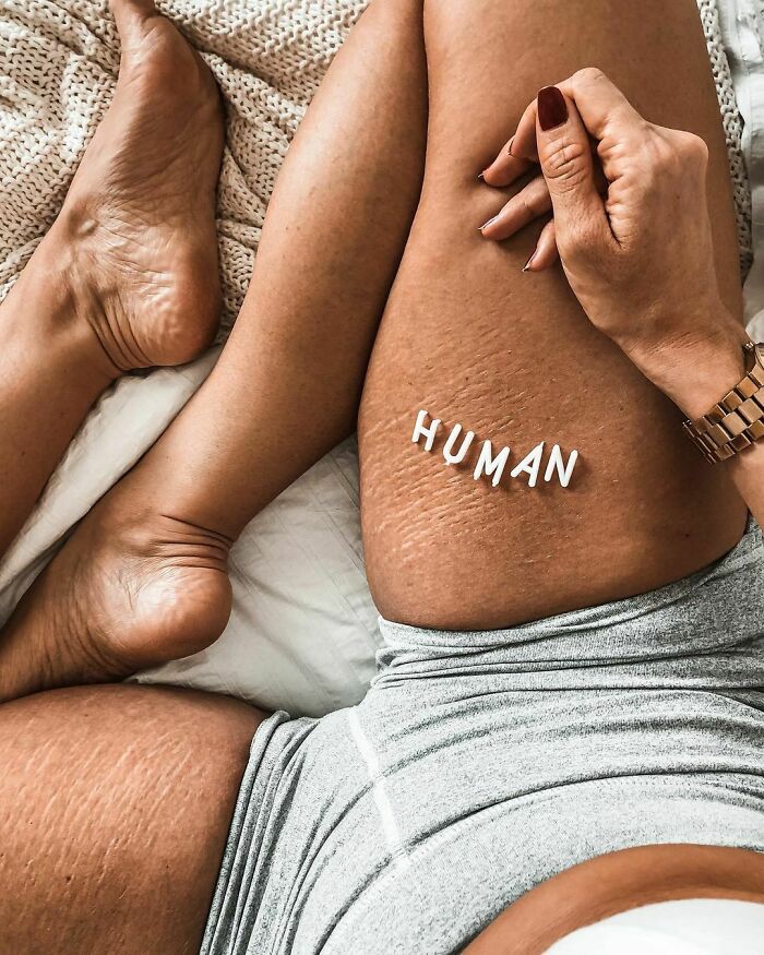 psicologiasdobrasil.com.br - Mulheres compartilham fotos sem edição para normalizar corpos reais