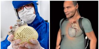 Autoridades europeias aprovam venda do primeiro coração artificial