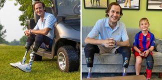 Após perder as duas pernas, ele criou fundação para doar próteses a crianças carentes