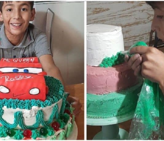 Menino de 10 anos faz bolos para pagar cirurgia reconstrutiva. Seu sonho é ser confeiteiro