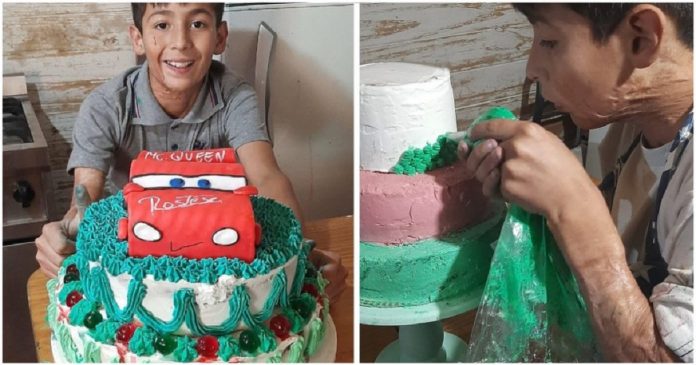 Menino de 10 anos faz bolos para pagar cirurgia reconstrutiva. Seu sonho é ser confeiteiro