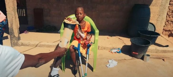 psicologiasdobrasil.com.br - Menino doa suas próteses todos os anos para uma menina da Gâmbia