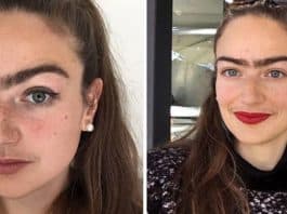 Jovem se diz mais confiante desde que parou de tirar os pelos do corpo