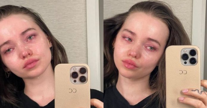 Dove Cameron faz honesto desabafo sobre disforia de imagem e depressão: ‘Nunca conheci a pessoa que exponho para o mundo’