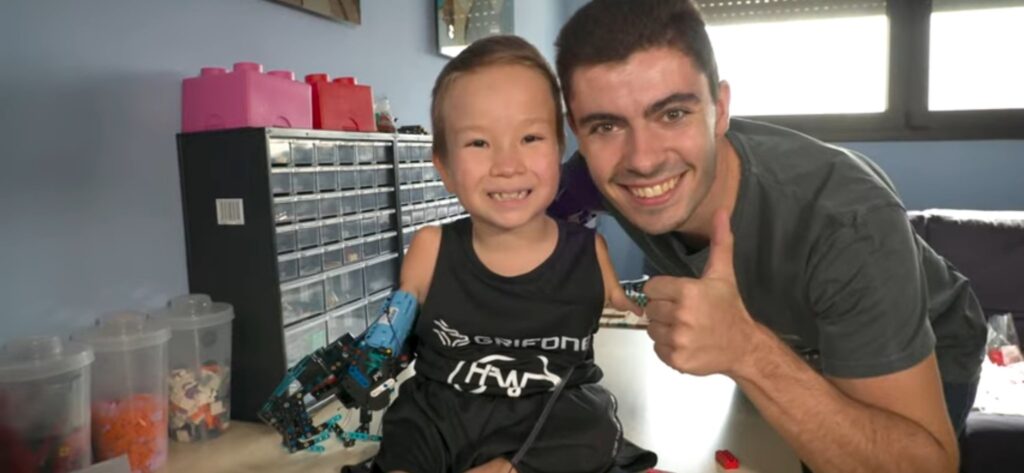 psicologiasdobrasil.com.br - Jovem que construiu seu próprio braço protético de LEGO aos 8 anos agora ajuda outras crianças