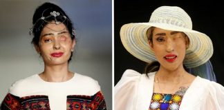 Vítimas de ataques com ácido no Irã retomam autoestima ao se tornarem modelos de passarela
