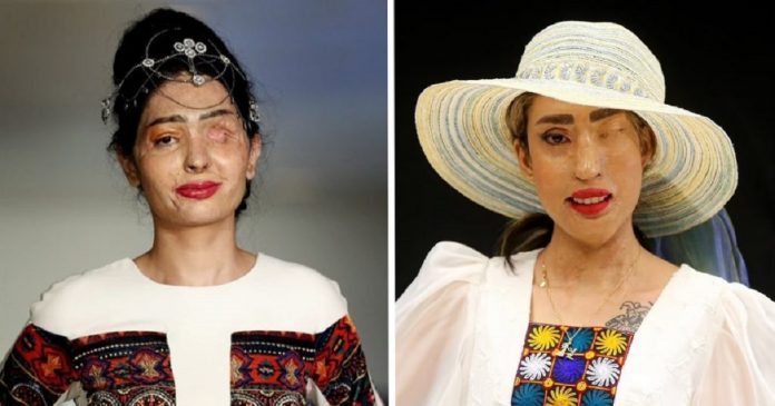 Vítimas de ataques com ácido no Irã retomam autoestima ao se tornarem modelos de passarela
