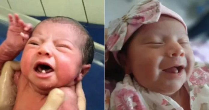 Bebê nasce com dois dentinhos e encanta a web; veja o vídeo!