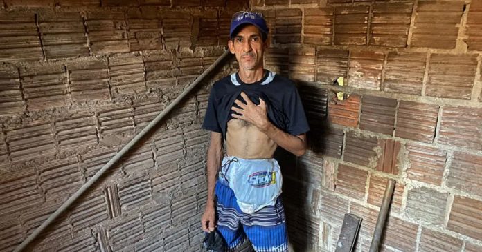 Por falta de bolsa de colostomia, paciente improvisa com sacola de supermercado: ‘Não aguento mais tanto sofrimento’