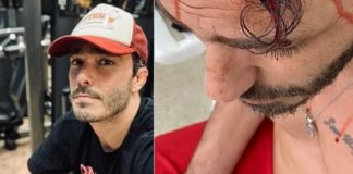 Thiago Rodrigues “está em choque” depois de ser espancado em assalto, diz empresária