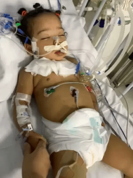 psicologiasdobrasil.com.br - Menina de 2 anos &eacute; internada com sintoma de gripe e sai com paralisia cerebral
