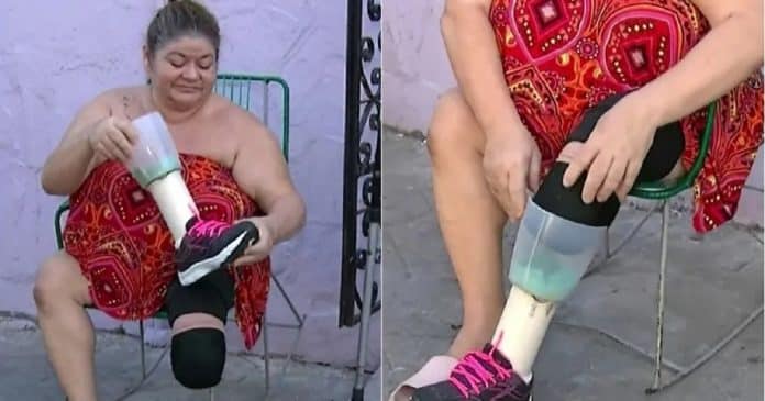 Mulher com a perna amputada faz prótese improvisada com liquidificador