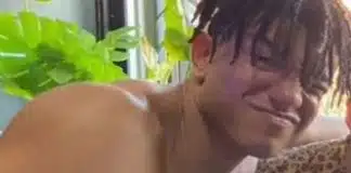 Jovem de 19 anos falece após sofrer crise de sinusite