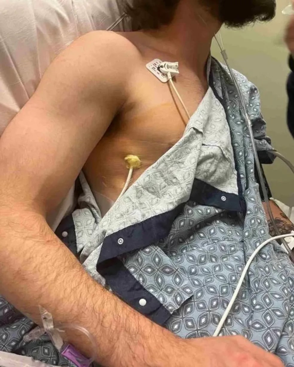 psicologiasdobrasil.com.br - Lutador de 20 anos expõe foto de pulmão danificado pelo vape