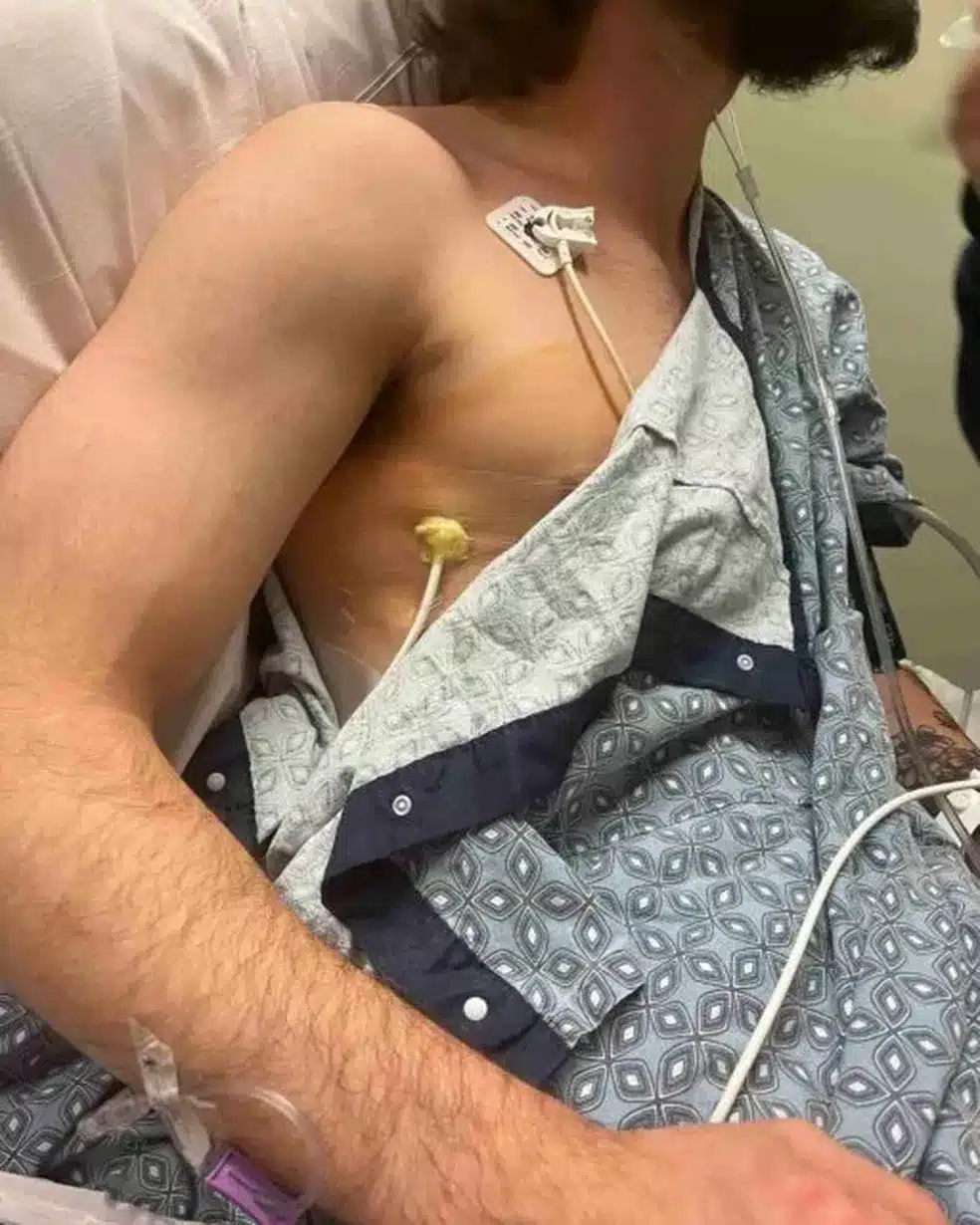 psicologiasdobrasil.com.br - Lutador de 20 anos expõe foto de pulmão danificado pelo vape