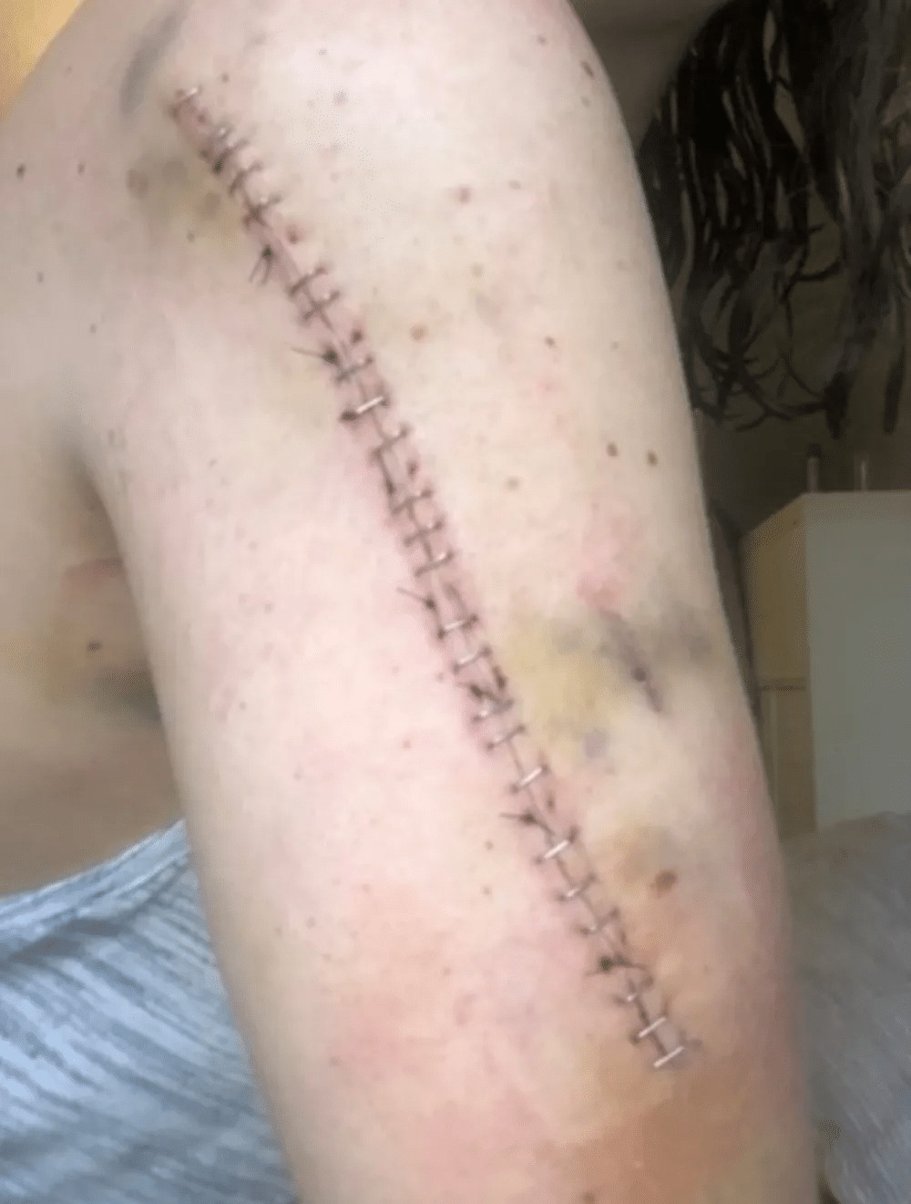 psicologiasdobrasil.com.br - Ap&oacute;s ser submetida a tratamento por 2 anos, mulher descobre que nunca teve c&acirc;ncer