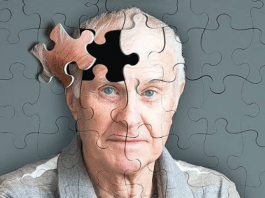 Estudo descobre novo sintoma de Alzheimer que surge no estágio inicial