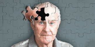 Estudo descobre novo sintoma de Alzheimer que surge no estágio inicial