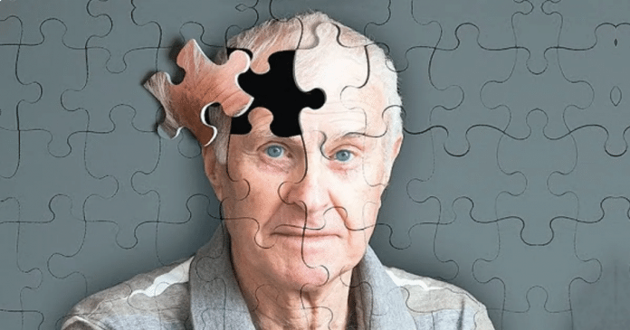 Estudo descobre novo sintoma de Alzheimer que surge no estágio inicial