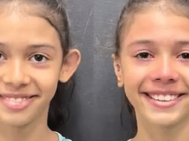 Vídeo: Menina chora ao se ver após procedimento para correção de orelhas