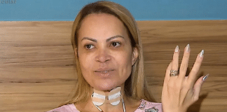 Solange Almeida vive pesadelo ao encarar sequelas de vício: ‘Me tirou do chão’