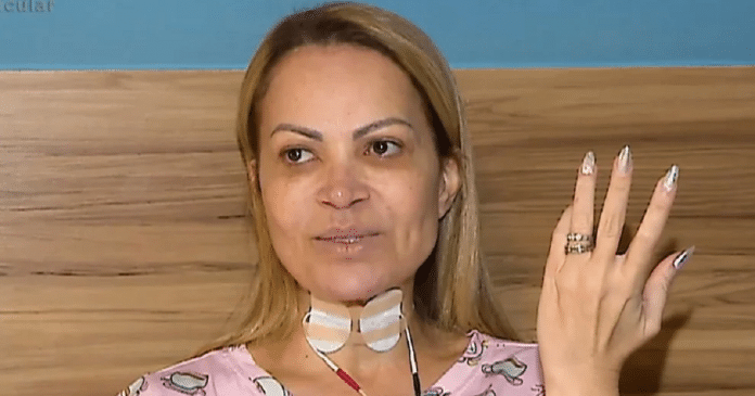 Solange Almeida vive pesadelo ao encarar sequelas de vício: ‘Me tirou do chão’