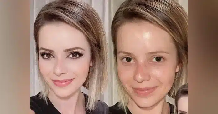 Psicólogo comenta se Sandy pode sofrer com distorção de imagem