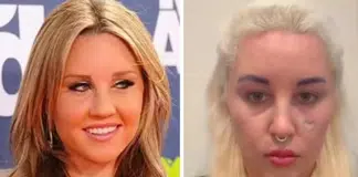 Amanda Bynes fala sobre ganho de peso em luta contra depressão