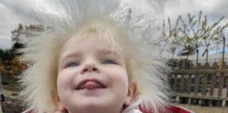 ‘O cabelo da minha filha é lindo’, diz mãe de menina com a síndrome do cabelo impenteável