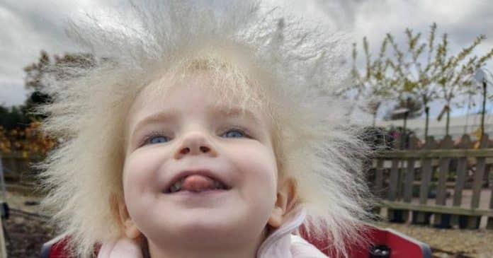 ‘O cabelo da minha filha é lindo’, diz mãe de menina com a síndrome do cabelo impenteável