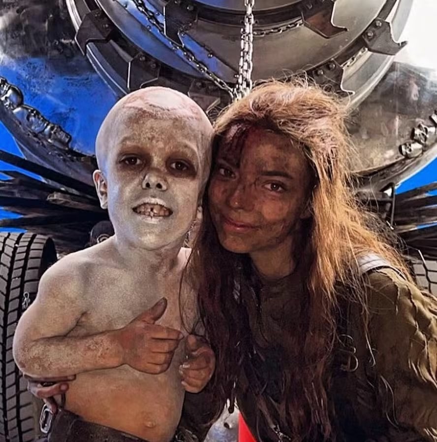psicologiasdobrasil.com.br - Garotinho com nanismo que foi vítima de bullying é um dos destaques do elenco de novo 'Mad Max'