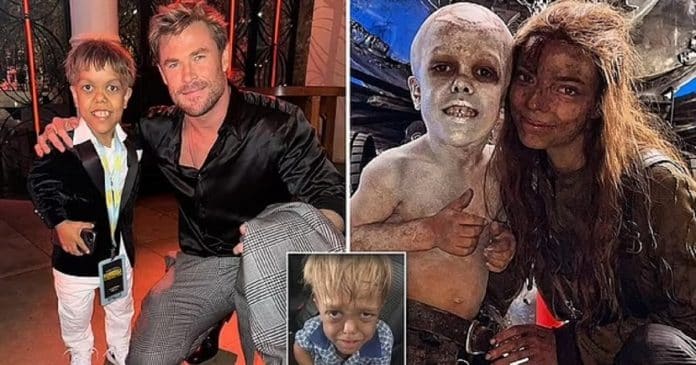 Garotinho com nanismo que foi vítima de bullying é um dos destaques do elenco de novo ‘Mad Max’