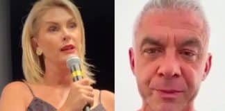 Ana Hickmann expõe hematomas e diz que ex-marido era um perigo para o filho