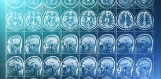 Exames de imagem identificam diferentes formas de depressão