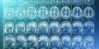 Exames de imagem identificam diferentes formas de depressão