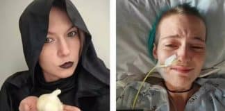 “Doença do vampiro” faz mulher vomitar até 30 vezes por dia; entenda!