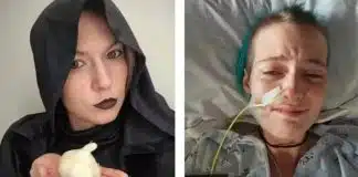 “Doença do vampiro” faz mulher vomitar até 30 vezes por dia; entenda!