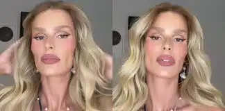 Após ter sua aparência criticada, Yasmin Brunet diz que vai processar médicos