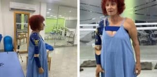 Roseana Murray usa prótese biônica pela primeira vez após ataque de pitbulls