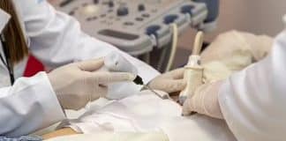Tratamento inovador contra câncer de mama congela tumor e alcança 100% de eficácia
