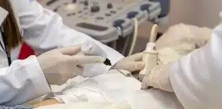 Tratamento inovador contra câncer de mama congela tumor e alcança 100% de eficácia