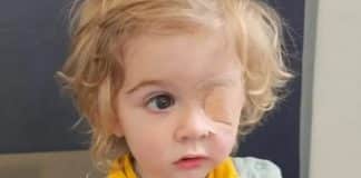 Um beijo no rosto fez menino de 2 anos perder a visão de um olho; entenda