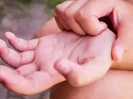 O que a coceira na mão esquerda realmente significa? O lado oculto que quase ninguém comenta