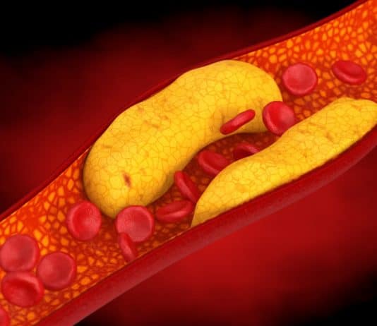 Cientistas descobriram uma maneira de desligar o colesterol, salvando milhões de vidas