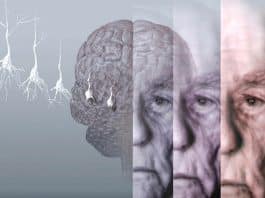 Quando chega ao SUS? Exame de sangue criado por cientistas brasileiros pode detectar Alzheimer com até 90% de precisão