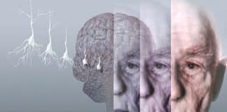 Quando chega ao SUS? Exame de sangue criado por cientistas brasileiros pode detectar Alzheimer com até 90% de precisão