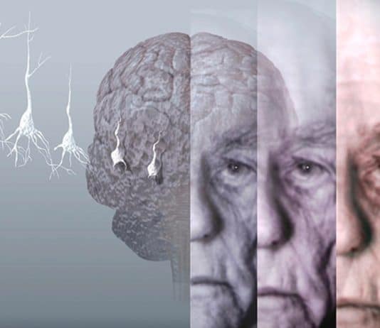Quando chega ao SUS? Exame de sangue criado por cientistas brasileiros pode detectar Alzheimer com até 90% de precisão