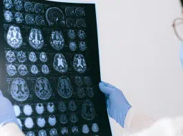 A ciência é clara: sofrimento prolongado altera o cérebro