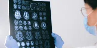 A ciência é clara: sofrimento prolongado altera o cérebro A ciência é clara: sofrimento prolongado altera o cérebro