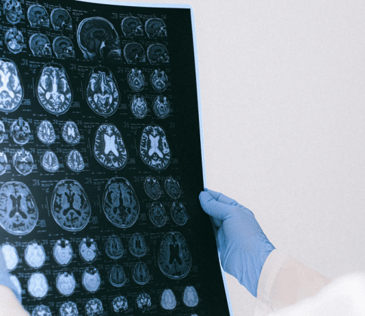 A ciência é clara: sofrimento prolongado altera o cérebro